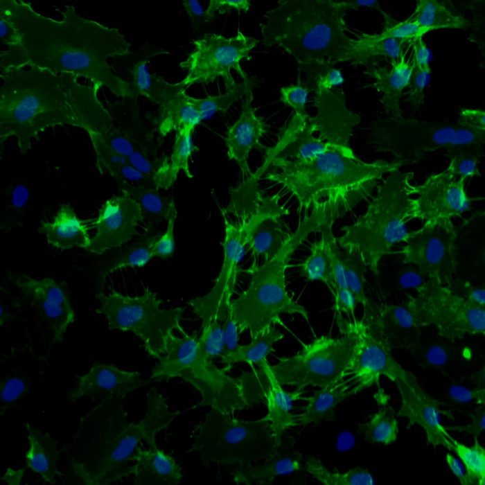 Human Aortic Endothelial Cells