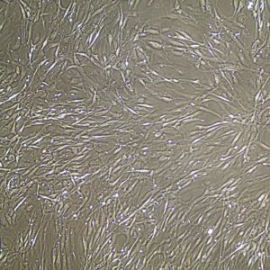 FC-0015 Aortic Smooth Muschle Cell, 10X, confluent