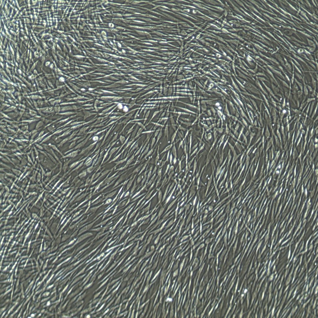 Human Dermal Fibroblasts Adult Primary Cells