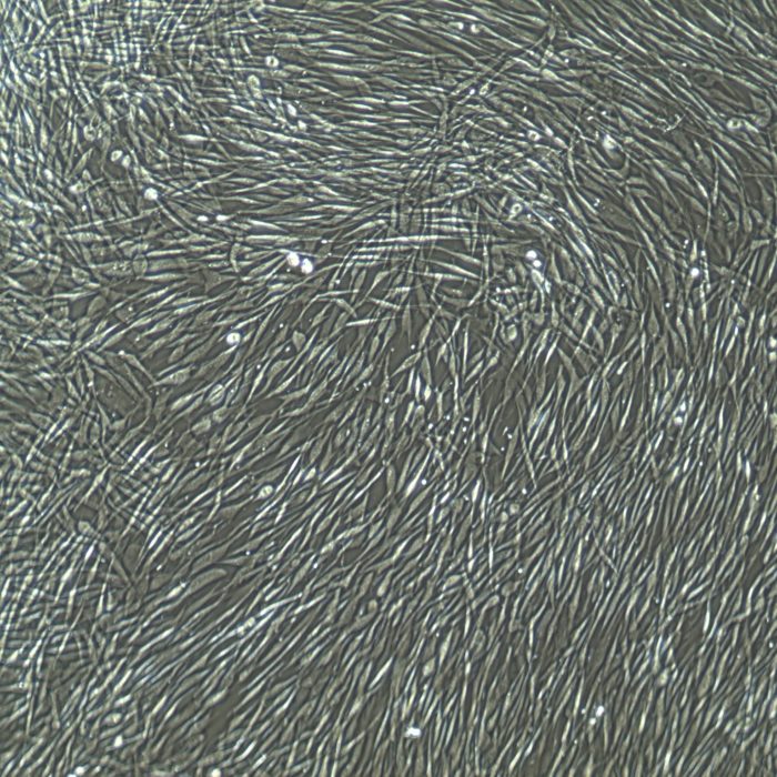 Human Dermal Fibroblasts Adult Primary Cells