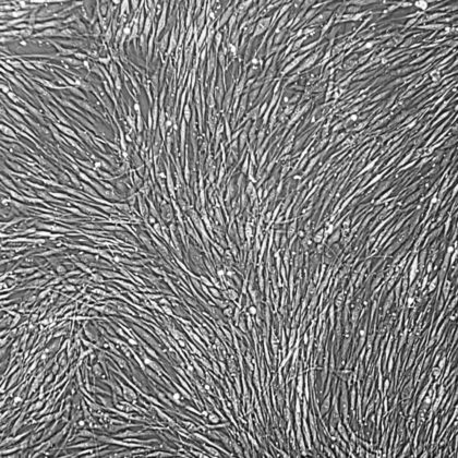 Human Epidermal Keratinocytes Adult Primary Cells