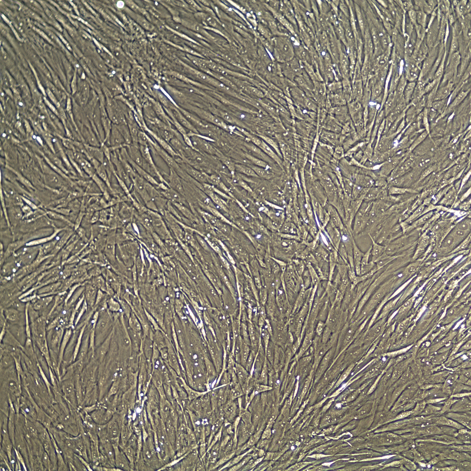 Primary Human Bladder Smooth Muscle Cells