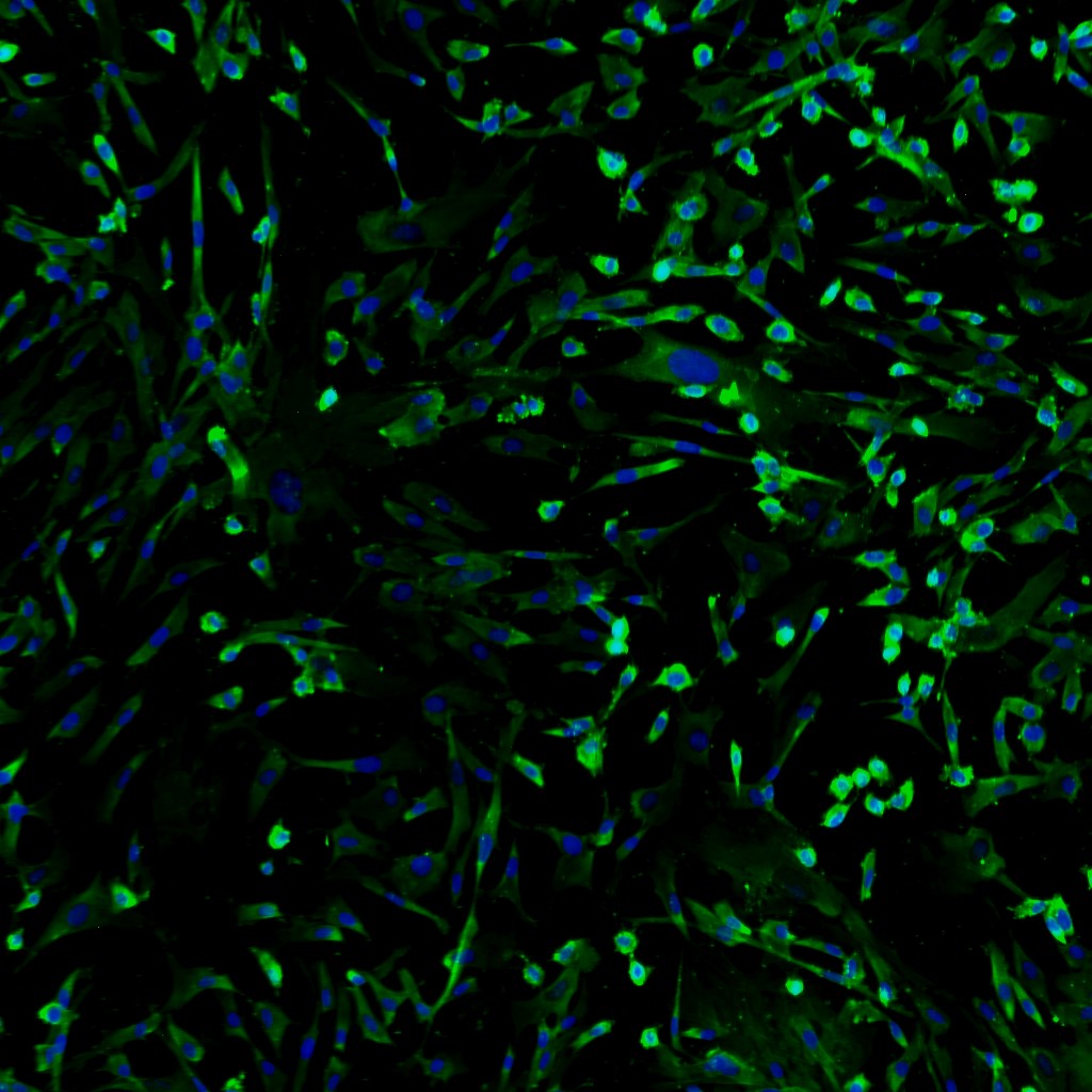 https://www.lifelinecelltech.com/wp-content/uploads/2015/09/FC-0043-Bladder-Smooth-Muscle-Cells-10x-stained-Actin-DAPI.jpg