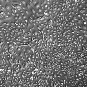 FC-0044, Pooled Umbilical Vein Endothelial Cells (HUVEC), 10x