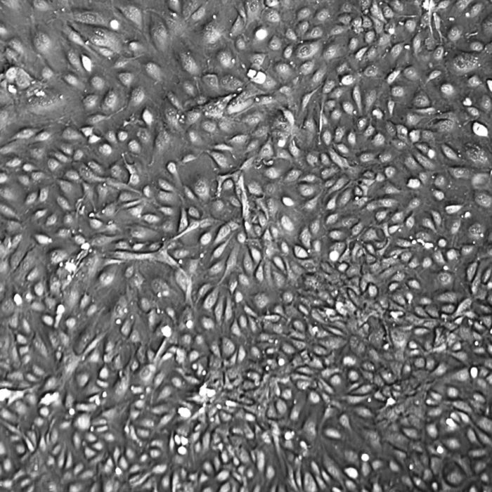 HUVEC 10-Donor Human Umbilical Vein Endothelial Cells