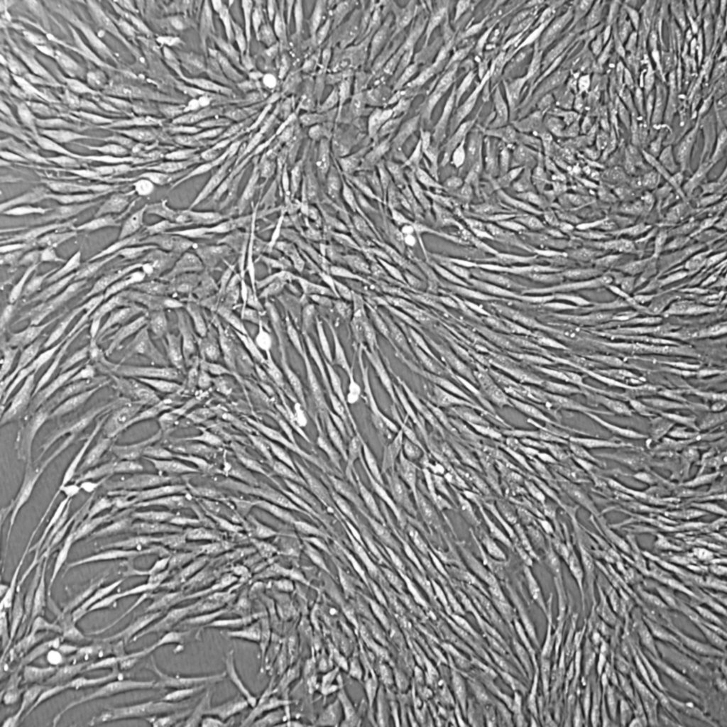 Human Uterine Cells Fibroblasts