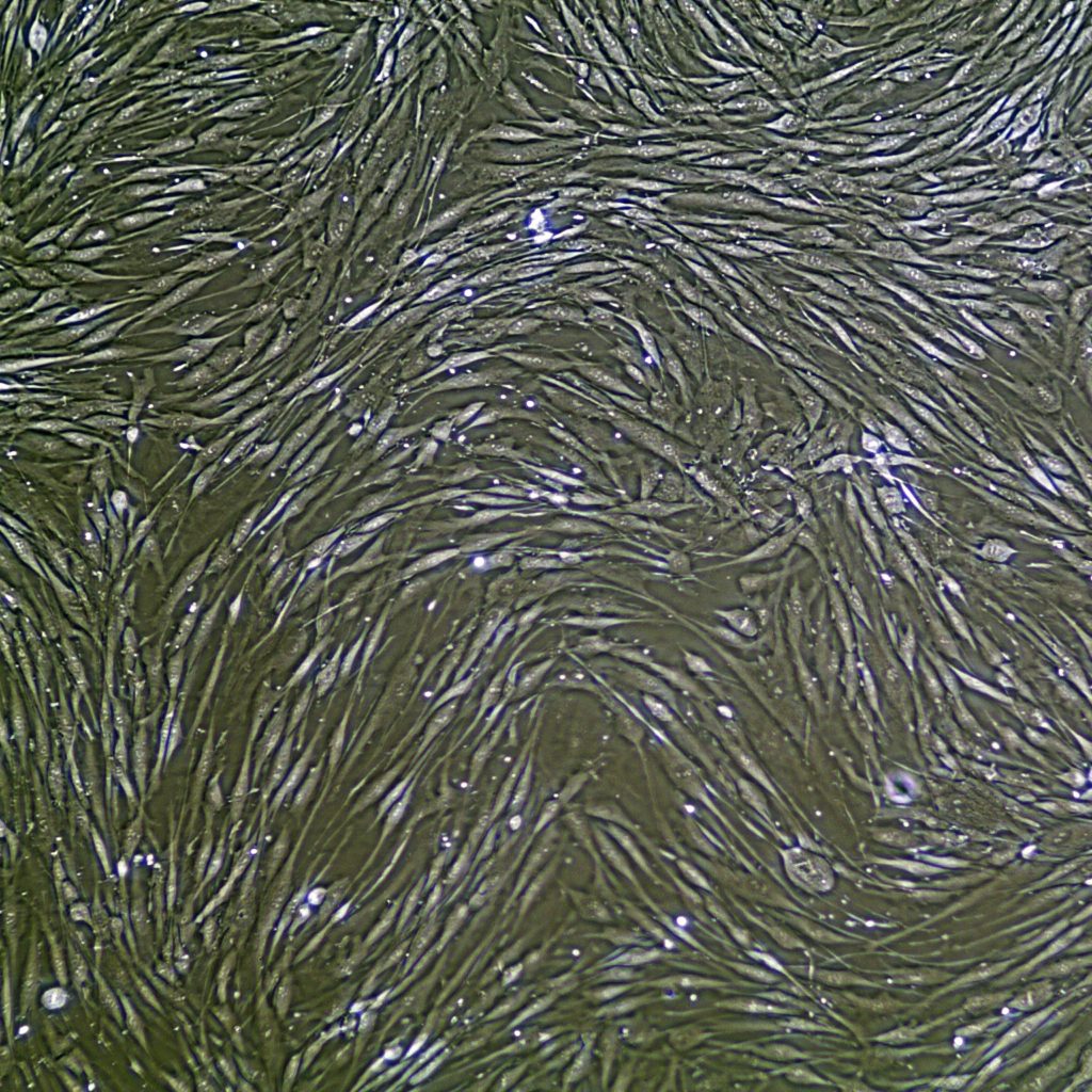 Human Gingival Fibroblasts