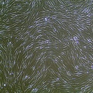 FC-0095 Human Gingival Fibroblasts, 10x