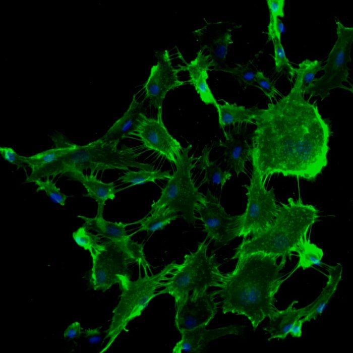 Human Lung Microvascular Endothelial Cells