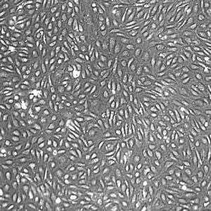 Primary Human Lung Cells for Cell Culture