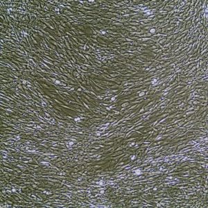 FC-0098 Human Scleral Fibroblasts, 10x