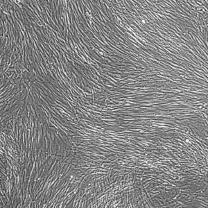 FC-0099, Prostate Fibroblasts, 10x