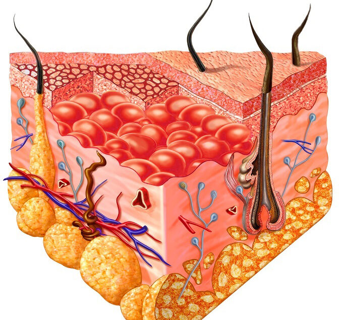 keratinocytes in skin