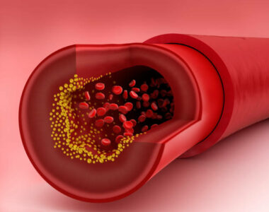 Primary Endothelial Cell Research Studies