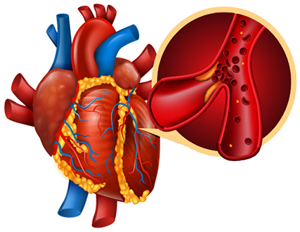 endothelium heart